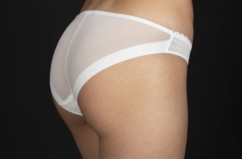 BRAGA VIVIAN MARFIL DETRAS