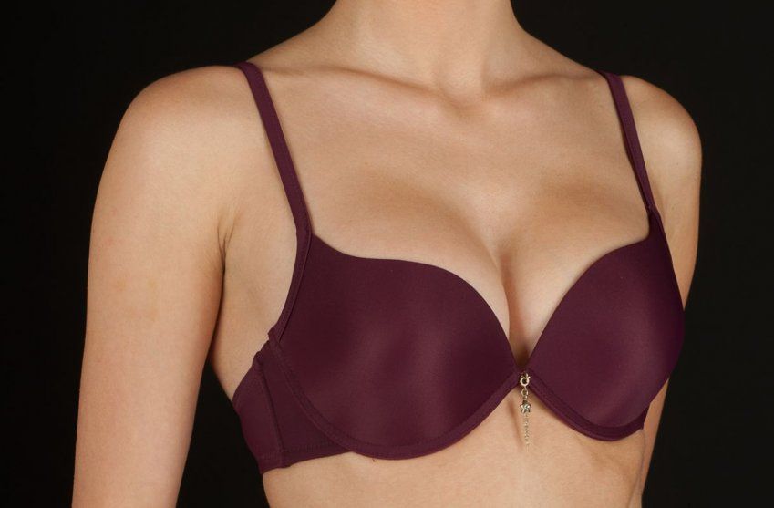 raquel burdeos 17w5940