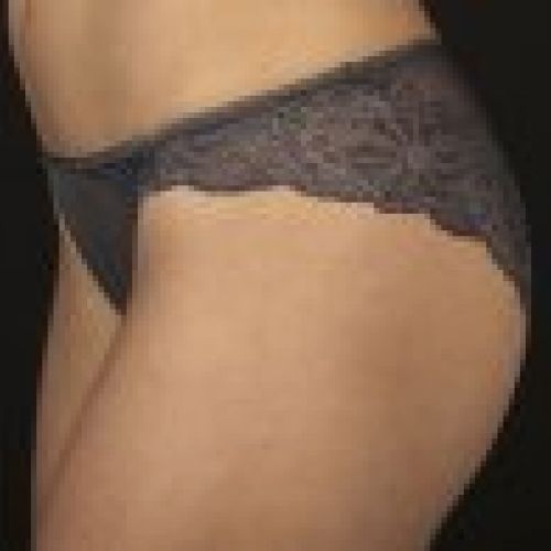 BIKINI 3091 GRIS